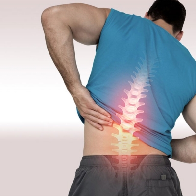 Gejala Saraf Terjepit